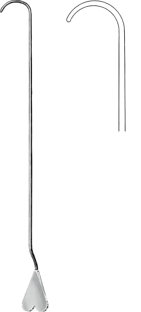 FISTUL PROP LOCKHART MUMMERY FIG.4